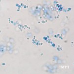 Saccharomyces_cerevisiae_micro