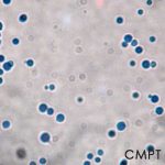 Cryptococcus_micro_OPT