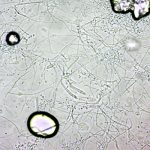 Trichophyton mentagrophytes