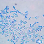 candida dubliniensis microscopic
