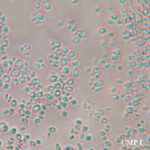 candida lusitaniae microscopic