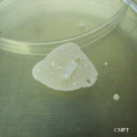 candida parapsilosis culture in saboureaud agar